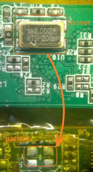12-MHz-crystal-on-donor-and-patient.jpg