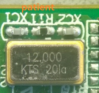 crystal-oscillator-soldered-on-patient.jpg