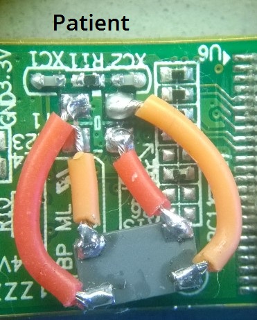 crystal-oscillator-wired-to-patient.jpg